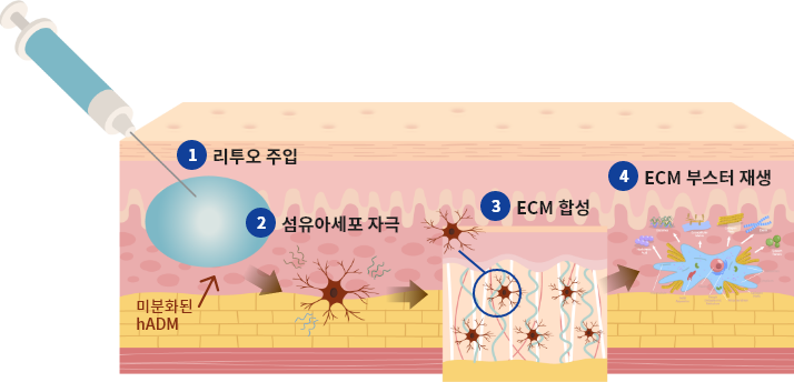 엘라비에 리투오