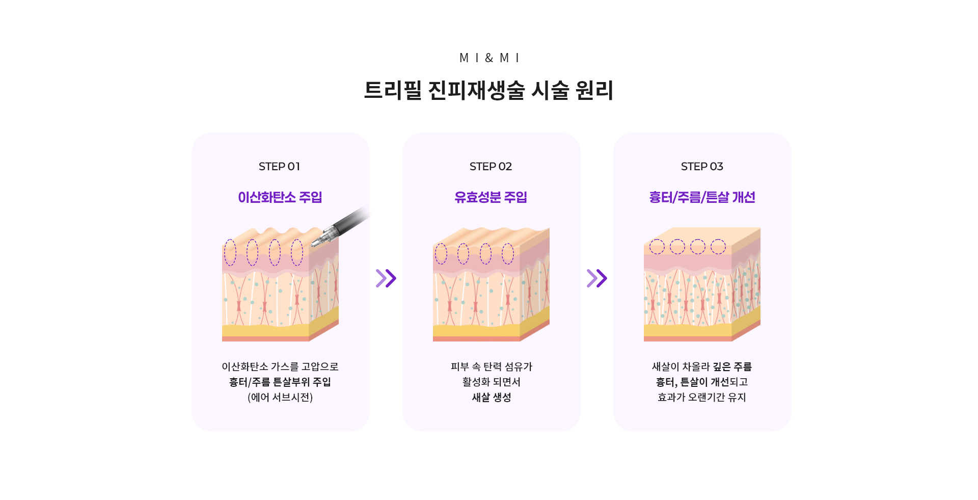 트리필 진피재생술 시술 원리
