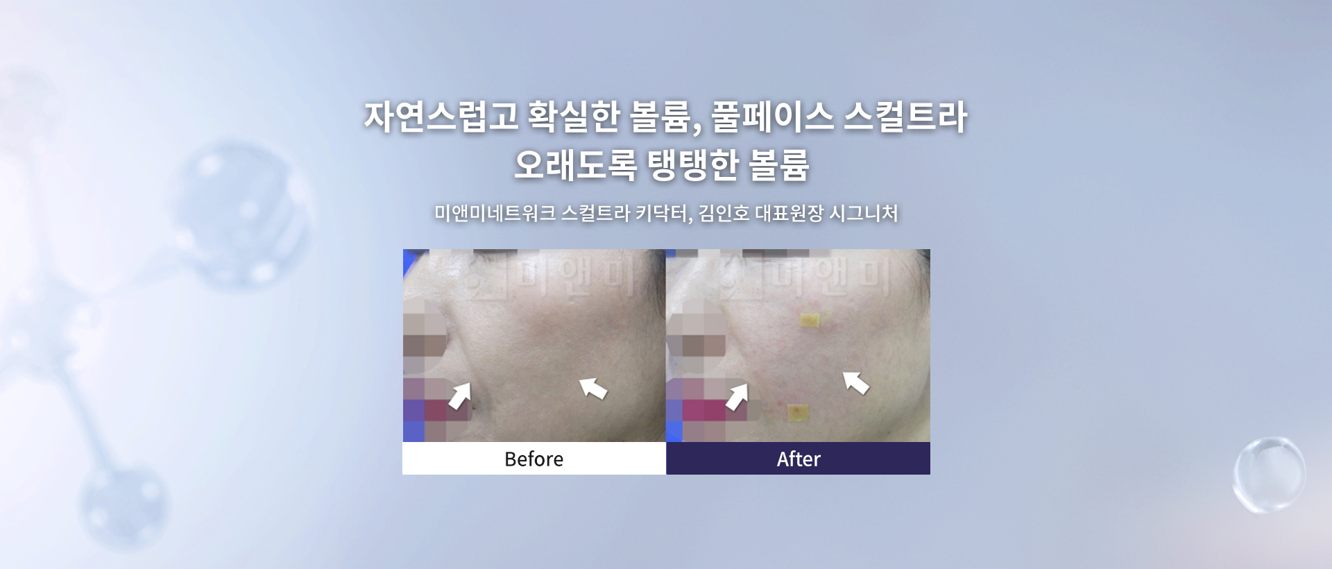 스컬트라